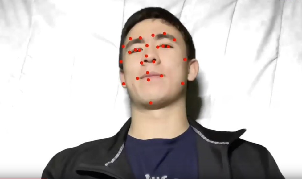 A picture of a young man's face with red dots on it
